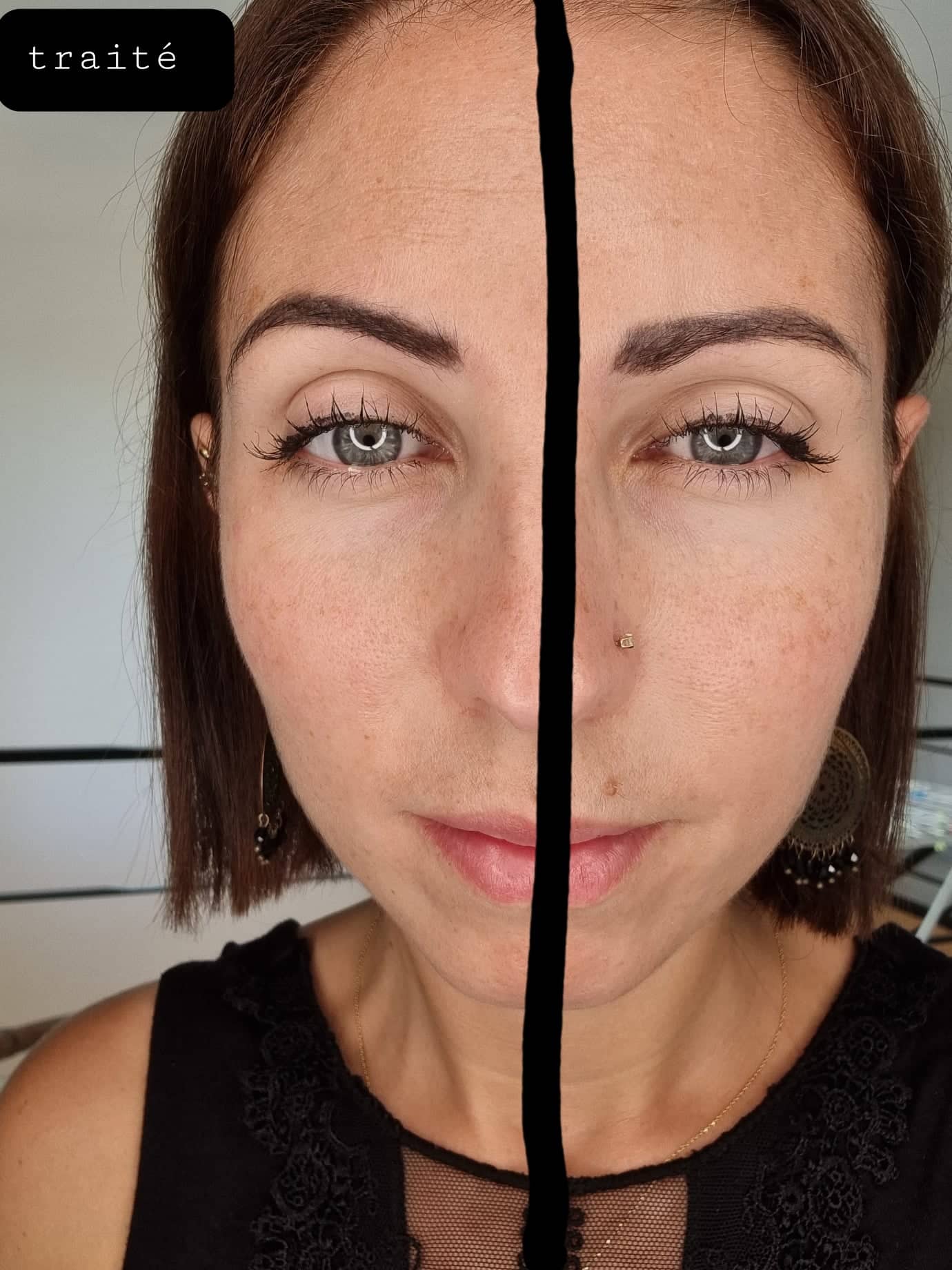 Appareil booster d'éclat, de beauté naturelle et de jeunesse