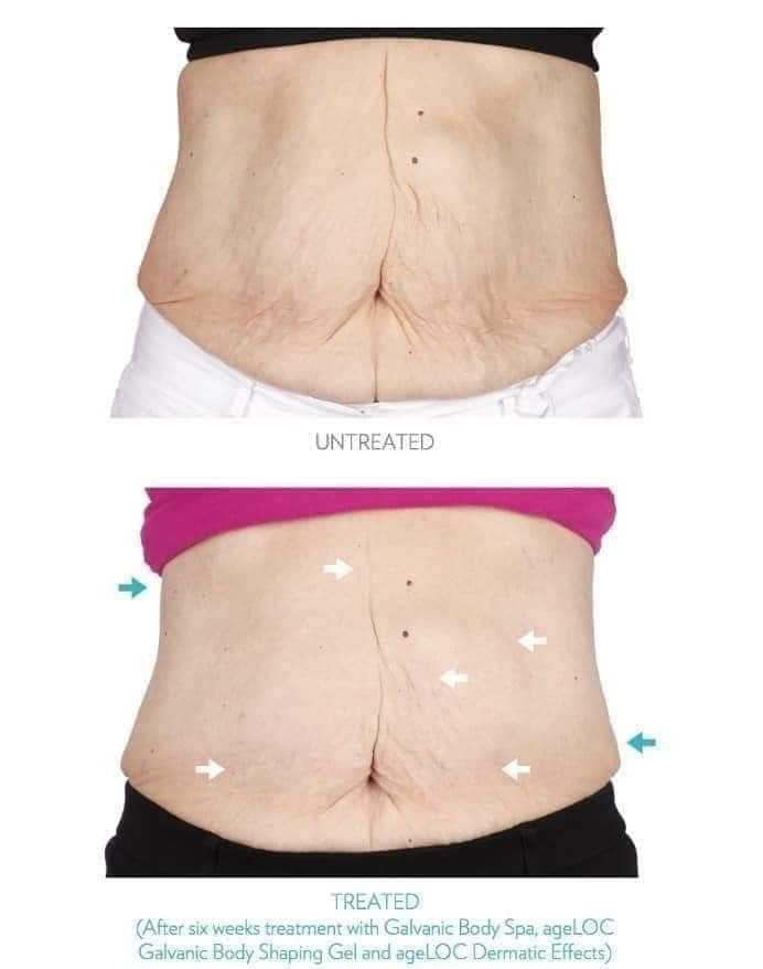 Appareil body spa qui dégomme tous les complexes corps