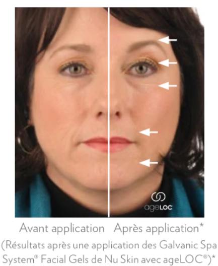 Appareil soin anti-âge pour visage, repasseur de rides