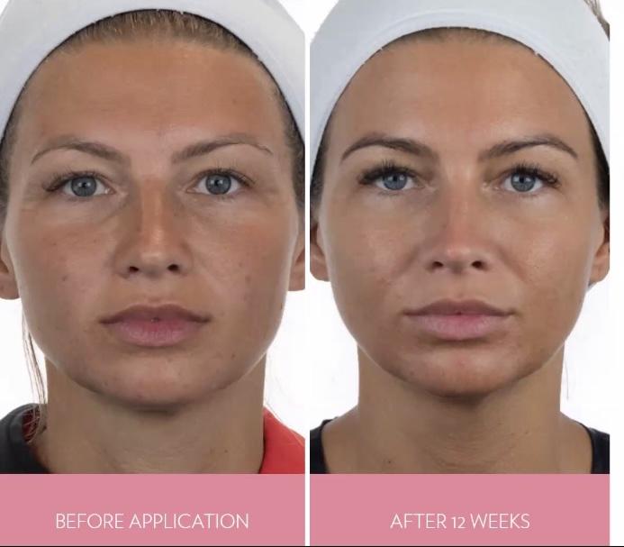 Appareil booster d'éclat, de beauté naturelle et de jeunesse