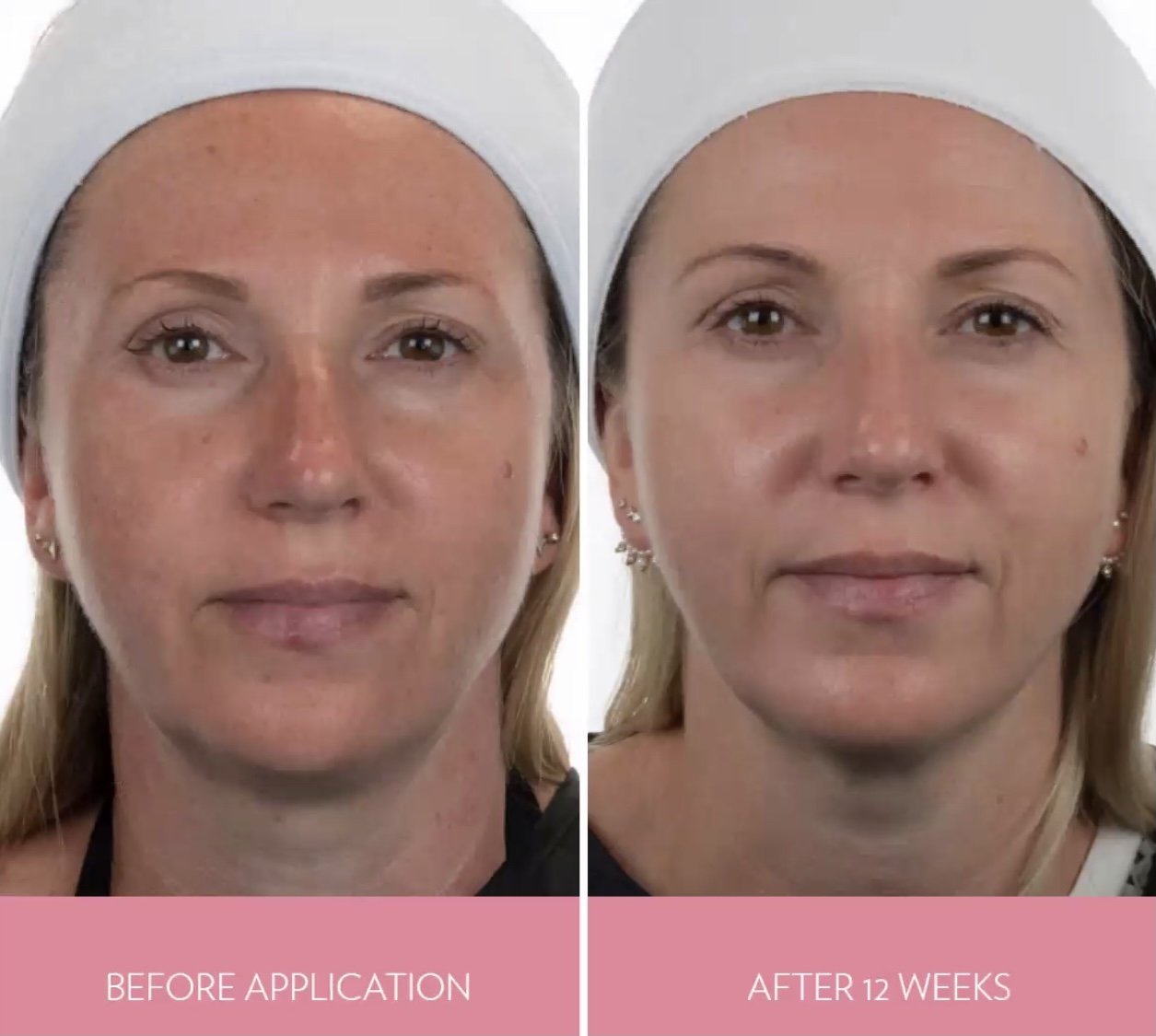 Appareil booster d'éclat, de beauté naturelle et de jeunesse